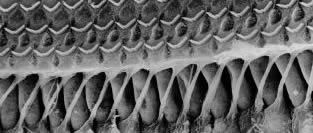 Stereocilia